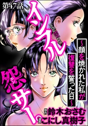 インフル怨サー。 ～顔を焼かれた私が復讐を誓った日～（分冊版）　【第47話】